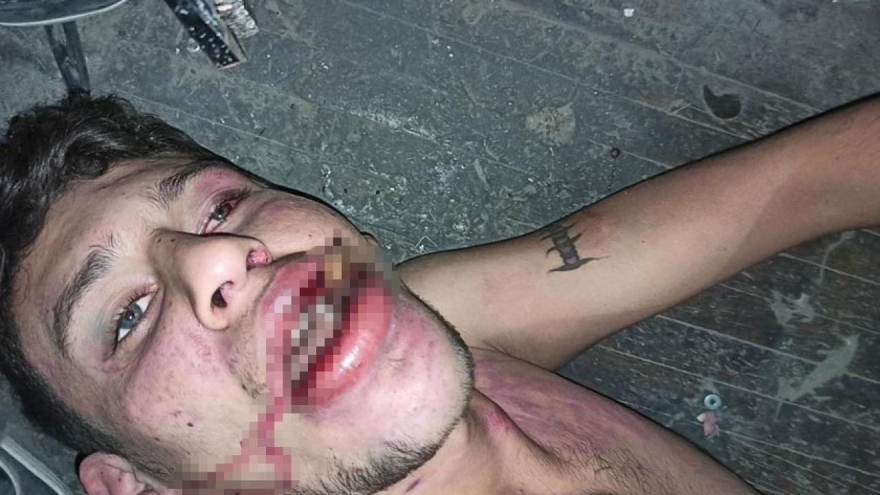 Antalya’da hamam böceği yedirilen gencin dosyasında karar verildi